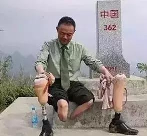 丁晓兵断臂照片背后的故事与拍摄者揭秘，丁晓兵断臂照片背后的故事，揭秘拍摄幕后与英雄传奇