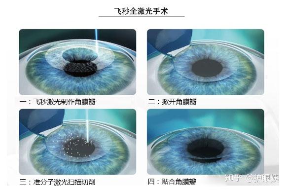军校视力要求最新规定,适应新时代军事需求的视力标准调整,军校视力标准最新规定,适应新时代军事需求的视力调整政策